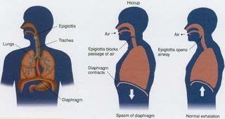Illustration for article titled Known about Hiccup TreatmentÂ